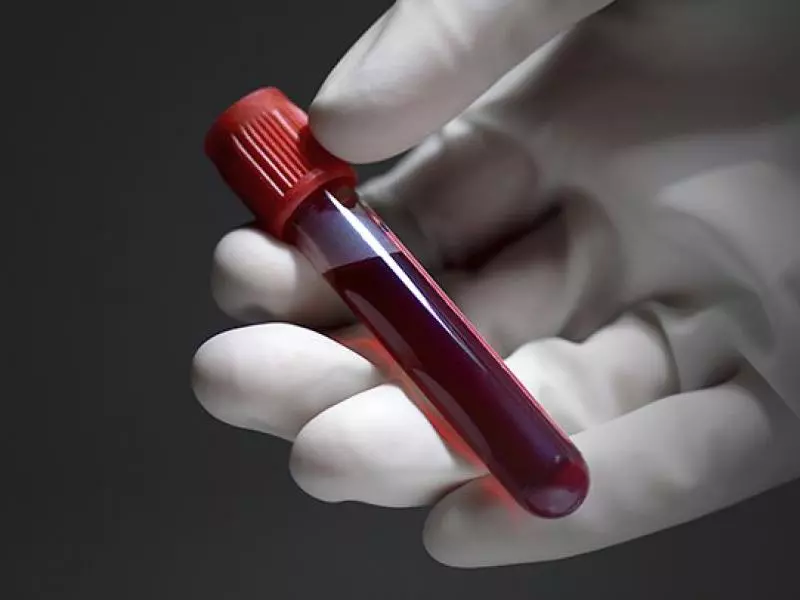 Anti CMV IgM Nedir?