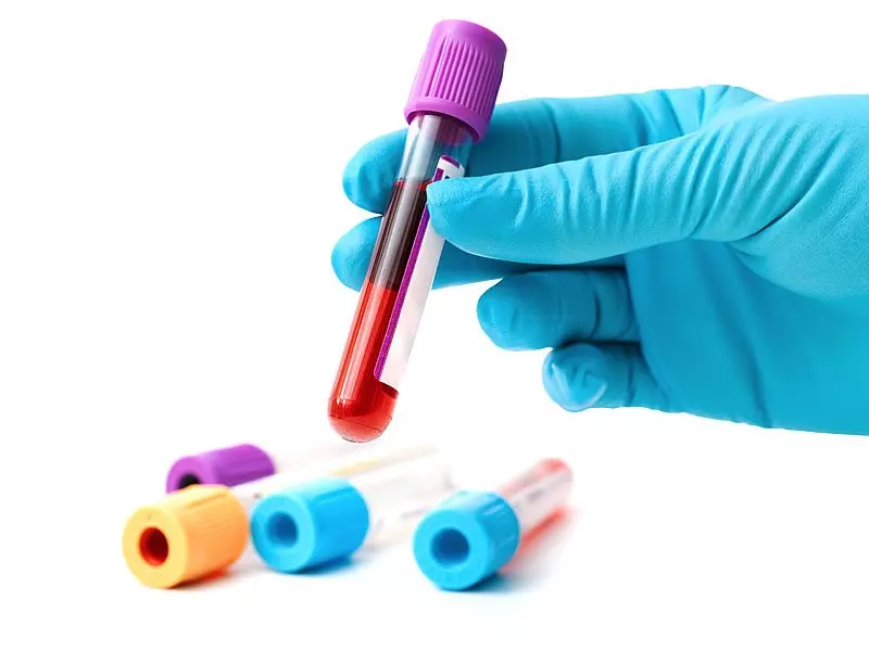 Anti Rubella IgG Nedir?