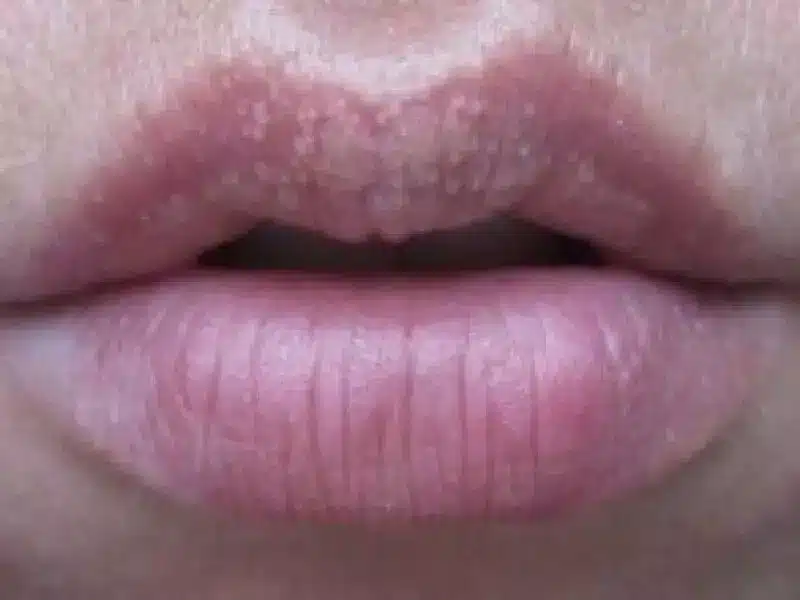 Dudak Sigili