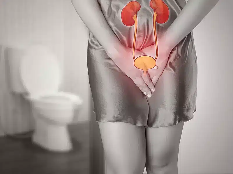 Lazer ile İdrar Kaçırma Tedavisi