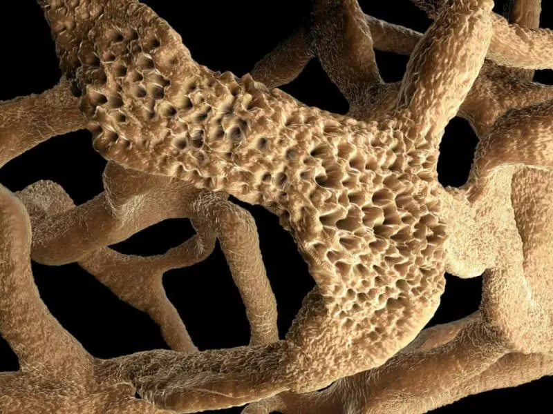 Osteopeni Nedir?