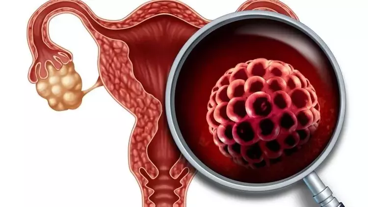 Papivir Hpv