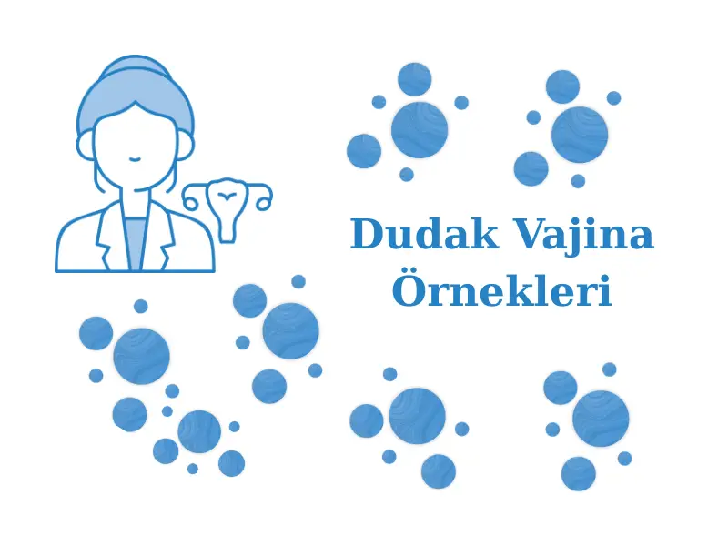Dudak Vajina Örnekleri