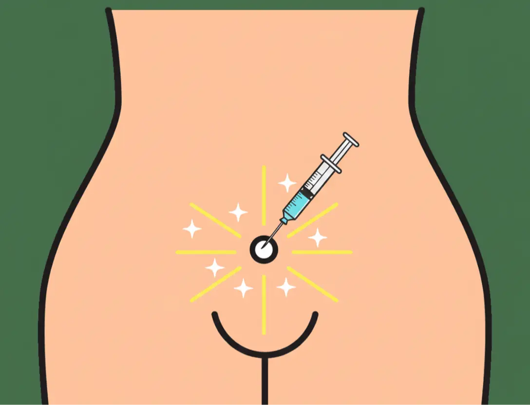 Genital Area Filler