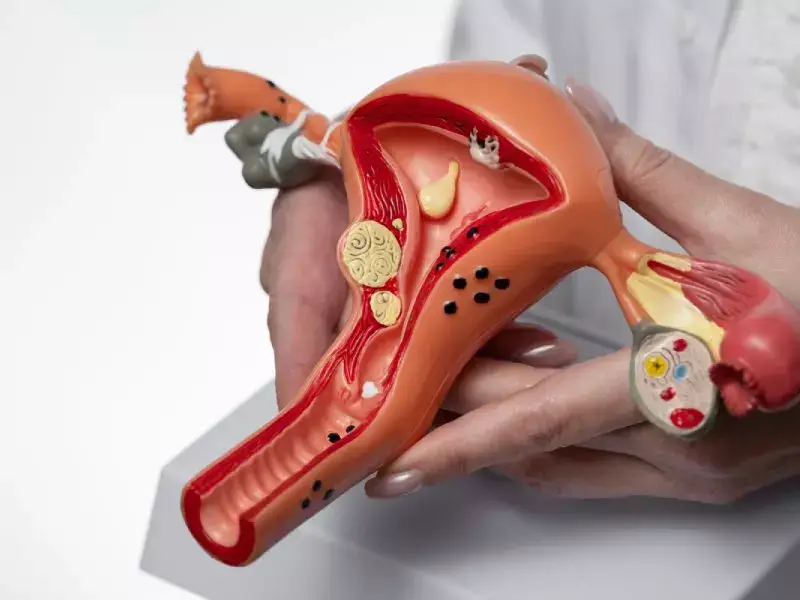 Hysterosalpingography (Uterine Imaging)