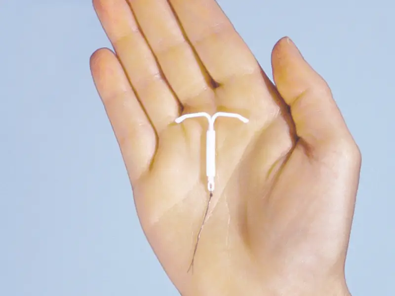 Intrauterine Device (IUD)
