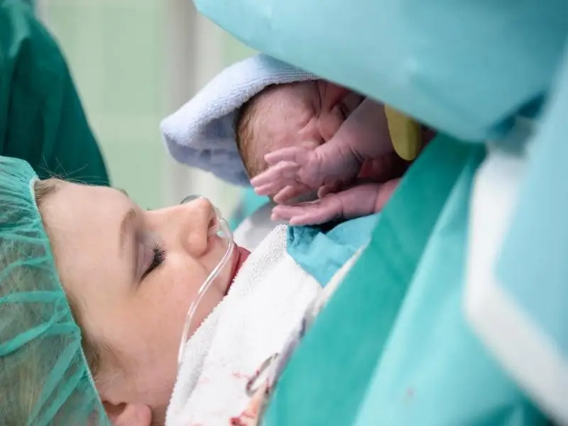 Cesarean Delivery