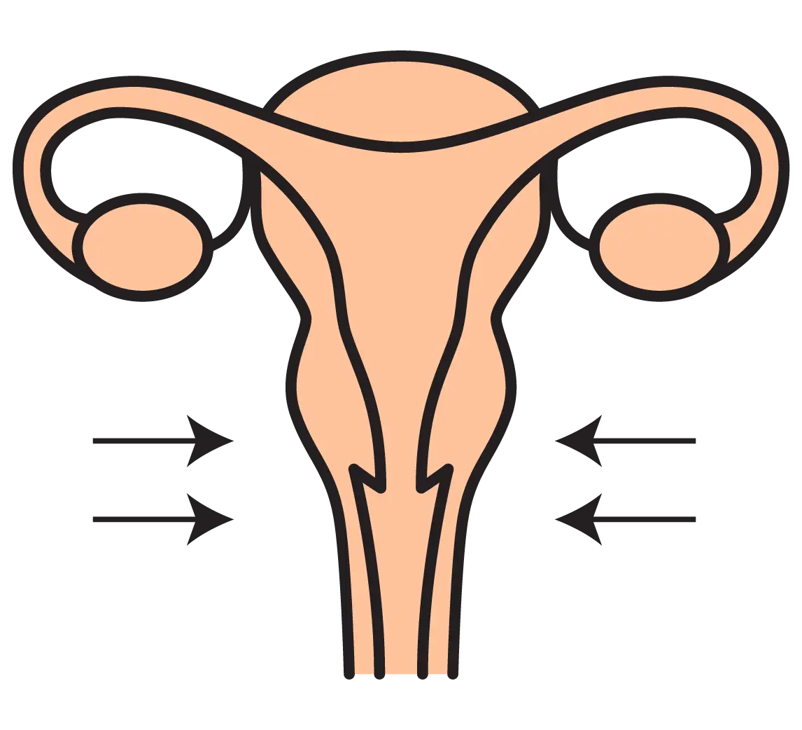 Vaginoplasty