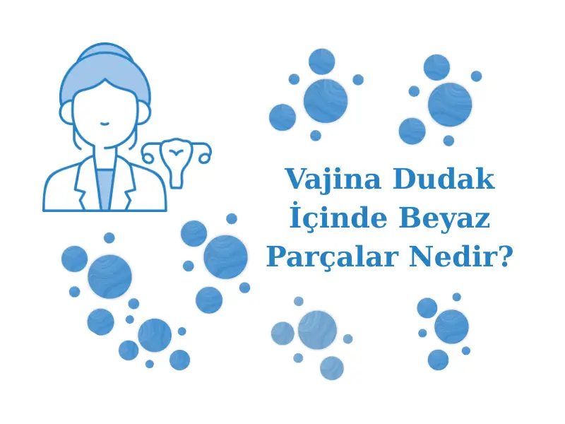 Vajina Dudak İçinde Beyaz Parçalar Nedir?