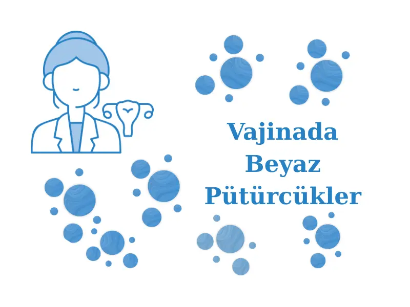 Vajinada Beyaz Pütürcükler
