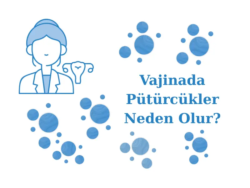 Vajinada Pütürcükler Neden Olur?